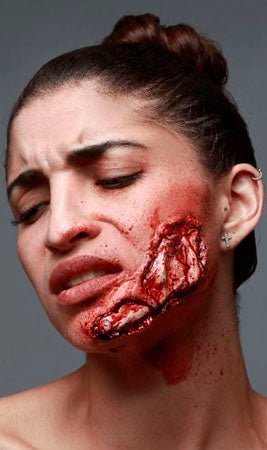 Wange-Wunde aus Latex
